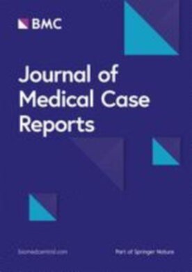 Journal of Medical Case Reports - Springer (13256) - modelo ABNT