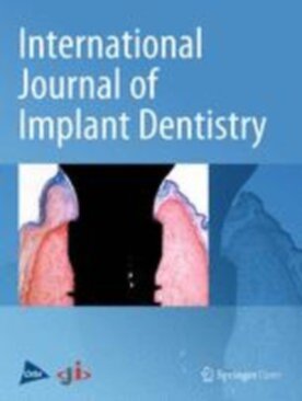 International Journal of Implant Dentistry - Springer (40729) - modelo ABNT